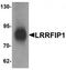 LRR Binding FLII Interacting Protein 1 antibody, TA319771, Origene, Western Blot image 