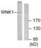 WNK1 antibody, LS-C117584, Lifespan Biosciences, Western Blot image 