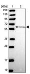 Zinc Finger Protein 530 antibody, PA5-61112, Invitrogen Antibodies, Western Blot image 