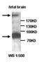 ADAM Metallopeptidase With Thrombospondin Type 1 Motif 2 antibody, orb76988, Biorbyt, Western Blot image 