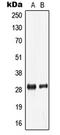 Low Density Lipoprotein Receptor Class A Domain Containing 2 antibody, LS-C353689, Lifespan Biosciences, Western Blot image 