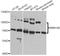 RNA Binding Motif Protein 15B antibody, A9873, ABclonal Technology, Western Blot image 
