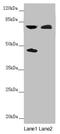 Centrosomal protein of 83 kDa antibody, LS-C682096, Lifespan Biosciences, Western Blot image 
