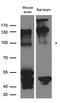 EK8 antibody, LS-C796631, Lifespan Biosciences, Western Blot image 