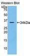 Lysyl oxidase homolog 4 antibody, LS-C295248, Lifespan Biosciences, Western Blot image 