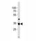 NK3 Homeobox 2 antibody, F45860-0.4ML, NSJ Bioreagents, Western Blot image 