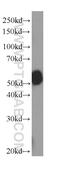 Kynurenine 3-Monooxygenase antibody, 60029-1-Ig, Proteintech Group, Western Blot image 