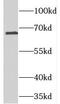 Translocase Of Outer Mitochondrial Membrane 70 antibody, FNab08861, FineTest, Western Blot image 