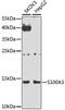 Protein S100-A3 antibody, GTX66434, GeneTex, Western Blot image 