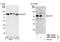 DnaJ Heat Shock Protein Family (Hsp40) Member C21 antibody, NBP1-03348, Novus Biologicals, Western Blot image 