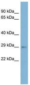 ARV1 Homolog, Fatty Acid Homeostasis Modulator antibody, TA338620, Origene, Western Blot image 