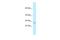 Eva-1 Homolog B antibody, PA5-69180, Invitrogen Antibodies, Western Blot image 