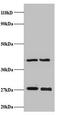 NADH:Ubiquinone Oxidoreductase Core Subunit V2 antibody, orb242265, Biorbyt, Western Blot image 