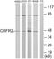 Corticotropin Releasing Hormone Receptor 2 antibody, LS-B9335, Lifespan Biosciences, Western Blot image 