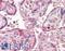 Fanconi anemia group E protein antibody, LS-B7400, Lifespan Biosciences, Immunohistochemistry paraffin image 
