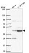 AP-4 complex accessory subunit tepsin antibody, NBP2-55976, Novus Biologicals, Western Blot image 