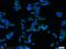 Armadillo Repeat Containing 3 antibody, 12856-1-AP, Proteintech Group, Immunofluorescence image 