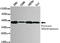 Pyruvate Dehydrogenase E1 Alpha 1 Subunit antibody, TA347015, Origene, Western Blot image 