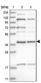KTI12 Chromatin Associated Homolog antibody, NBP1-81176, Novus Biologicals, Western Blot image 