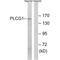 Phospholipase C-gamma-1 antibody, A00677, Boster Biological Technology, Western Blot image 