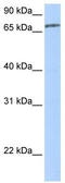 Zinc Finger Protein 418 antibody, TA339788, Origene, Western Blot image 
