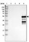 Cytochrome P450 Family 2 Subfamily C Member 19 antibody, NBP1-85488, Novus Biologicals, Western Blot image 