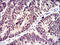 Ephrin A2 antibody, orb329885, Biorbyt, Immunohistochemistry paraffin image 