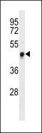 Yes Associated Protein 1 antibody, LS-C160678, Lifespan Biosciences, Western Blot image 