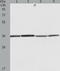 60S acidic ribosomal protein P0 antibody, TA323511, Origene, Western Blot image 