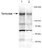 Tankyrase-1 antibody, PA1-16550, Invitrogen Antibodies, Western Blot image 