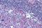 CD40 Molecule antibody, NBP1-39881, Novus Biologicals, Immunohistochemistry paraffin image 