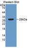 Laminin Subunit Beta 4 antibody, LS-C374308, Lifespan Biosciences, Western Blot image 