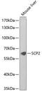 Sterol Carrier Protein 2 antibody, GTX33487, GeneTex, Western Blot image 