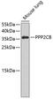 Protein Phosphatase 2 Catalytic Subunit Beta antibody, 19-013, ProSci, Western Blot image 