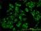 Acyl-CoA Binding Domain Containing 3 antibody, H00064746-M01, Novus Biologicals, Immunocytochemistry image 