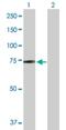 Zinc Finger BED-Type Containing 5 antibody, H00058486-B01P, Novus Biologicals, Western Blot image 