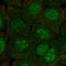 Chromosome 10 Open Reading Frame 67 antibody, HPA038130, Atlas Antibodies, Immunocytochemistry image 