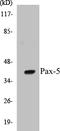 Paired Box 5 antibody, EKC1442, Boster Biological Technology, Western Blot image 