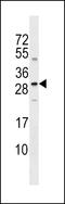 Sclerostin antibody, LS-C159063, Lifespan Biosciences, Western Blot image 