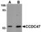 Coiled-Coil Domain Containing 47 antibody, TA306882, Origene, Western Blot image 