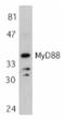 MYD88 Innate Immune Signal Transduction Adaptor antibody, TA305998, Origene, Western Blot image 