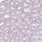 Zinc Finger Protein 688 antibody, HPA048922, Atlas Antibodies, Immunohistochemistry paraffin image 