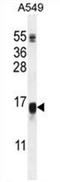 WAP Four-Disulfide Core Domain 12 antibody, AP54561PU-N, Origene, Western Blot image 