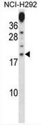 Proline Rich 15 antibody, AP53457PU-N, Origene, Western Blot image 