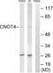 CCR4-NOT Transcription Complex Subunit 4 antibody, A08405, Boster Biological Technology, Western Blot image 