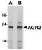 hAG-2 antibody, TA319825, Origene, Western Blot image 