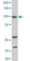 Aldehyde Dehydrogenase 1 Family Member L1 antibody, ab56777, Abcam, Western Blot image 