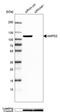 AMP deaminase 2 antibody, NBP2-47549, Novus Biologicals, Western Blot image 