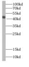 Interleukin-1 family member 5 antibody, FNab04238, FineTest, Western Blot image 