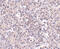 Zinc transporter ZIP10 antibody, 4991, ProSci Inc, Immunohistochemistry paraffin image 